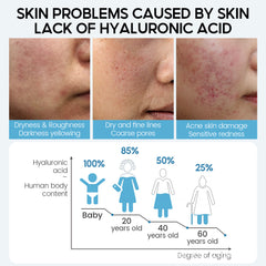 Hyaluronic - Acid - Face Serum